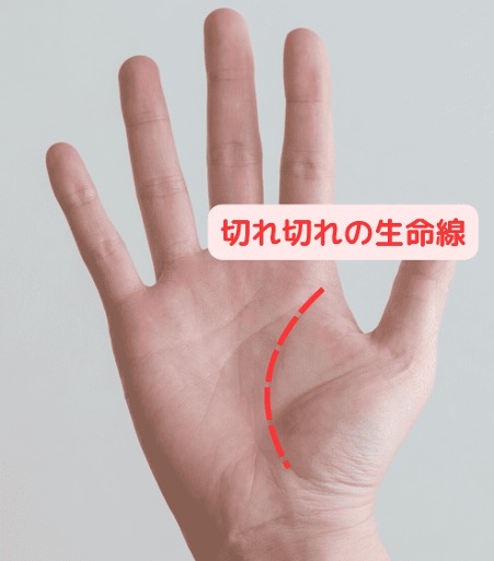 健康要注意!切れ切れの生命線