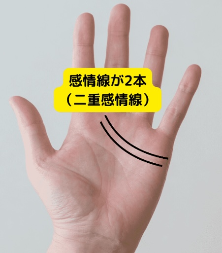 (9)愛が重すぎる?「感情線が2本(二重感情線)」