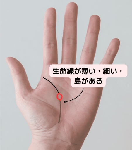 (20)体力低下!「生命線が薄い・細い・島がある」